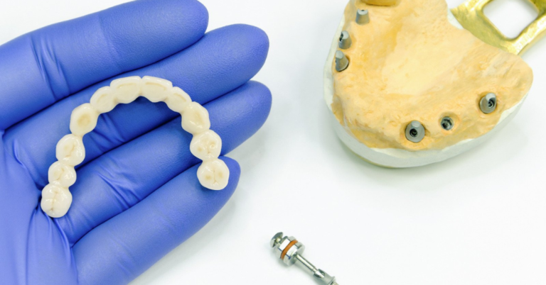 What Is The Difference Between Endosteal And Subperiosteal Dental Implants?