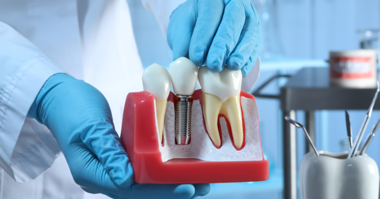 Are there any restrictions on the types of food I can eat with dental implants?