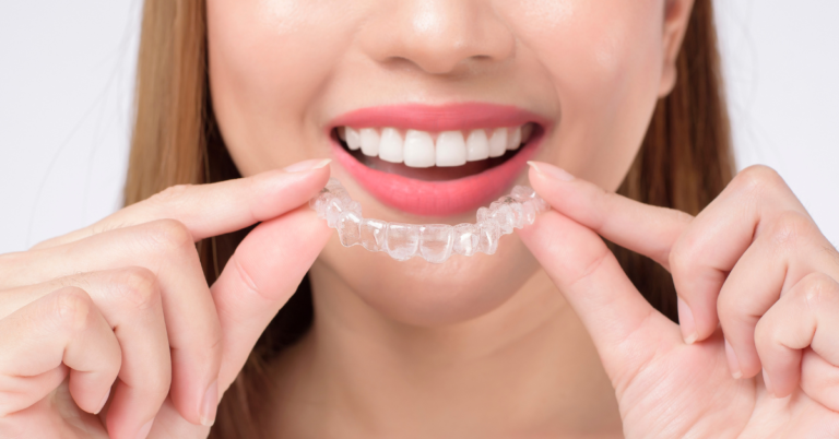 How do I handle any discomfort or soreness during Invisalign treatment?